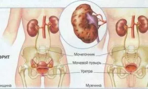 Лекарства для лечения почек: список таблеток, на травах, антибиотики