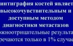 Какие заболевания выявляет сцинтиграфия костей скелета