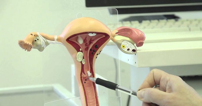 Биопсия шейки матки: как делают и что показывает