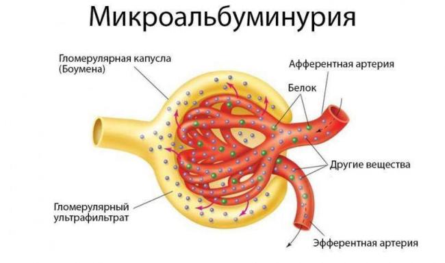Belok-v-urine-pri-mikroalbuminurii.-Istochnik-mypochka.ruf.jpg