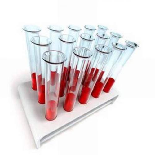 Проведение общего анализа и биохимии крови позволяет определить болезнь