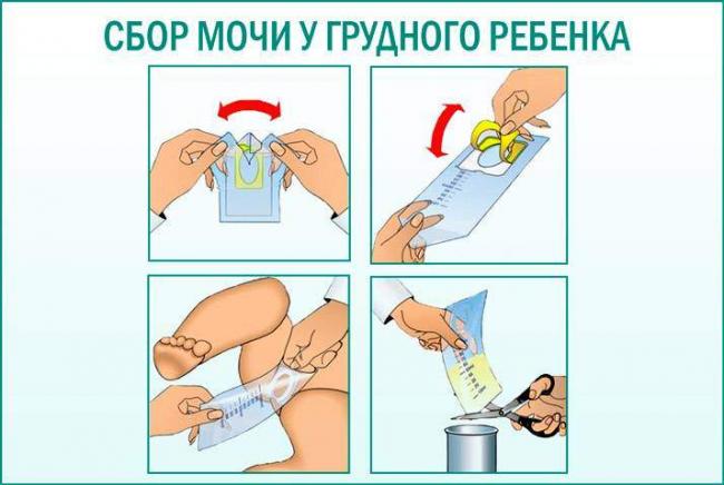 Paket-dlya-sbora-uriny-u-novorozhdennyh.-Istochnik-uromir.ru_.jpg