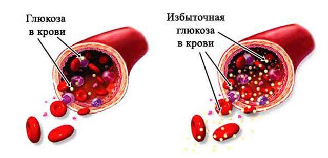 blood-glucose-1.jpg