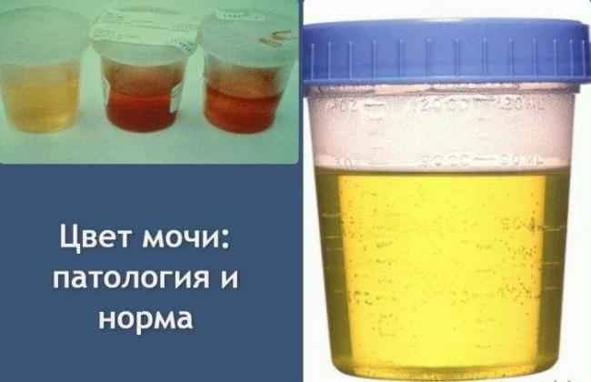 urina2-e1490201775266-1024x662.jpg