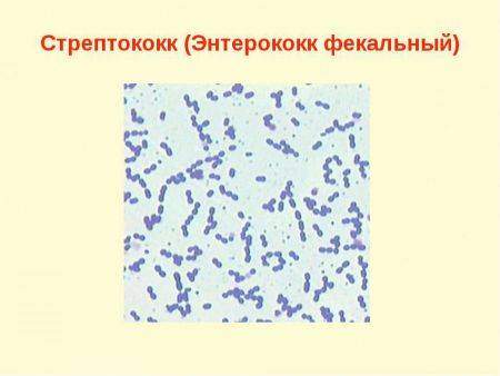 enterococcus-fae-moch-2-450x338.jpg