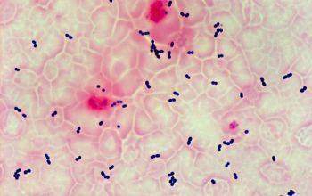 Enterococcus_fecal_1.jpg