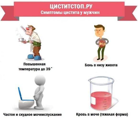 TSistitStop.ru-----simptomyi-tsistita-u-muzhchin-min.jpg