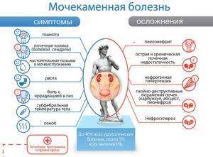 mochekamennaya-bolezn-simptomyi-oslozhneniya-300x221.jpg