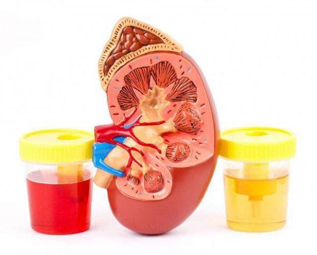 Kidney-Urine-1.jpg