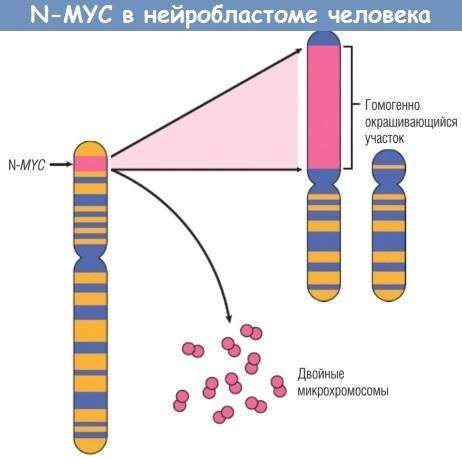 хромосомы-и-N-myc.jpg