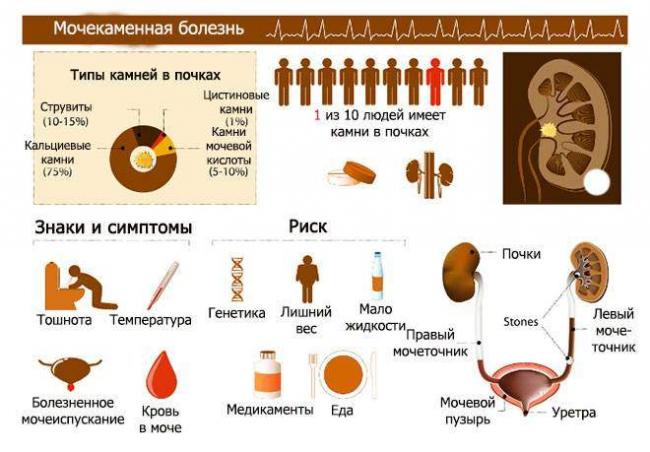 Pesochnaya-urina-shema.jpg