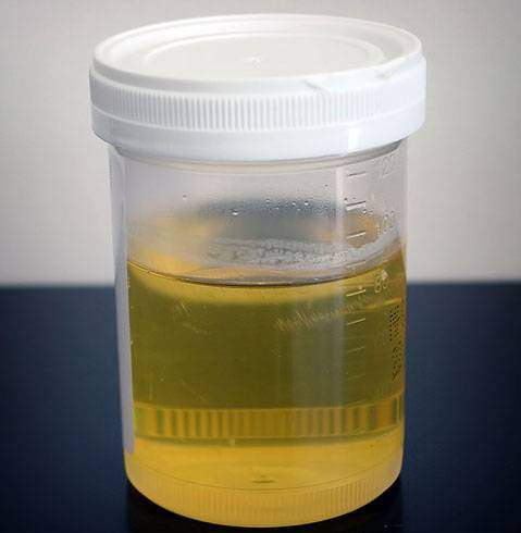 urine99.jpg