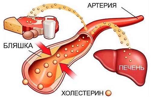 ateroskleroz-i-prostata.jpg