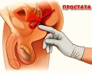 6_palcevyj-massazh-prostaty-v-klinike-300x237.jpg