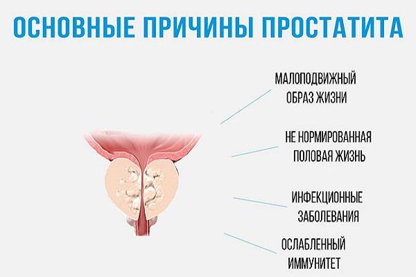 imptomy-hron-prostat.jpg